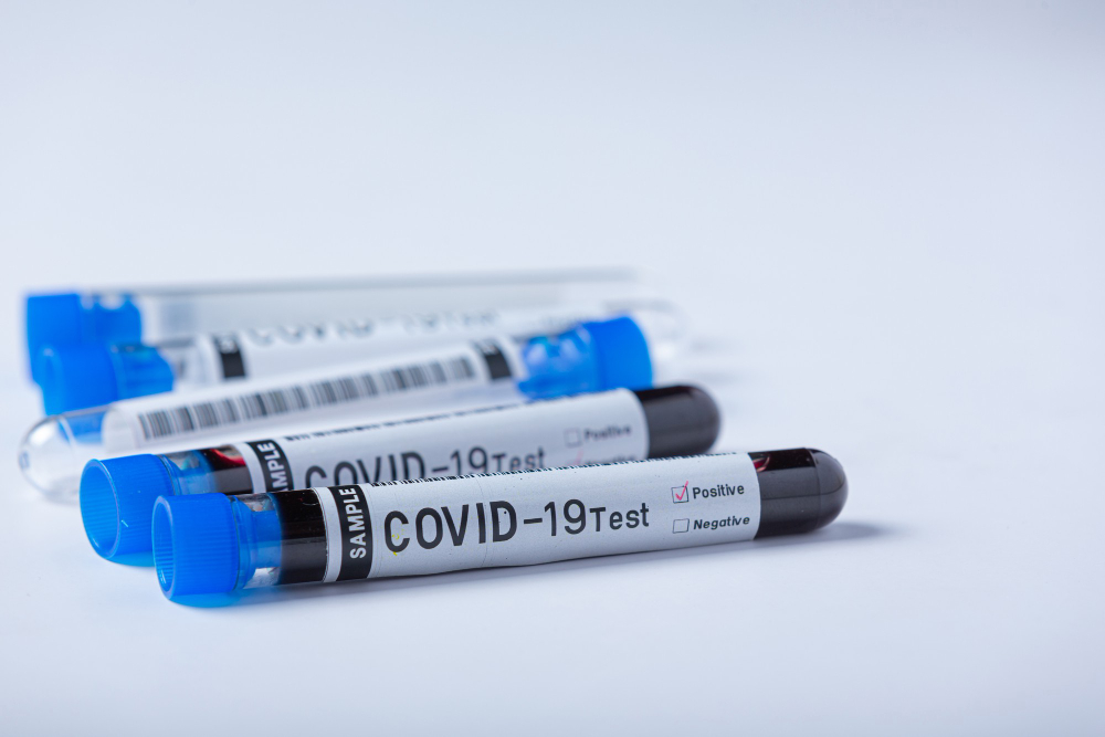 Анализ на covid-19