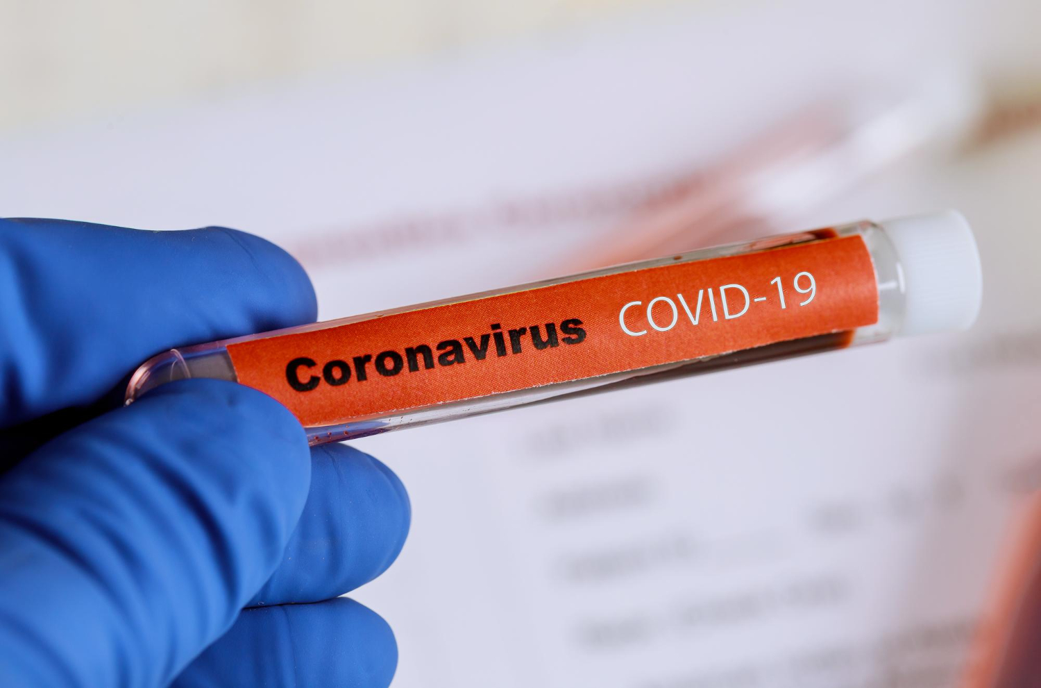 Основные группы риска при коронавирусе Covid-19