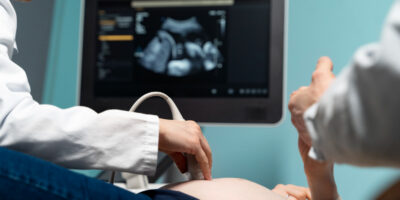 эмбрион на УЗИ